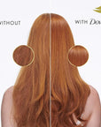 Dove Damage Therapy Shampoo Daily Moisture for Dry Hair with Bio-Protein Care Technology and Hyaluronic Serum 28 Fl Oz