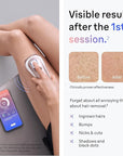 Braun IPL Skin i·expert, at Home Laser Hair Removal, Permanent Visible Hair Reduction, Holiday Gifts for Women and Men with Free App, SMART IPL, Vanity Case, Venus Razor, 4 Smart Heads, PL7387