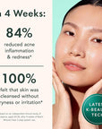 Rael Toner for Face, Miracle Clear - Reducing Pores and Oils with Succinic Acid, Hydrating Vitamin B5, Vegan, Korean Skin Care (5.1 fl oz)
