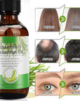 Rosemary Oil for Hair Growth, 100% Natural Cold Pressed Rosemary Hair Oil, Multipurpose Rosemary Essential Oils for Skin, Aromatherapy for Women & Men