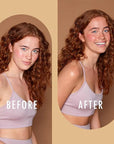 St Moriz Advanced Miracle Glow Face Tanner Serum - Hydrating Self Tan Face Serum, 30ml - With Q10 & Hyaluronic Acid - Natural Sunless Radiant Glow & Gradual Face Self Tanner - Dermatologically Tested