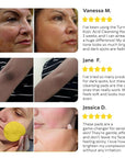 Turmeric Kojic Acid Cleansing Pads - Exfoliating Turmeric Pads for Face Dark Spots, Discoloration - Daily Skin Care for Men & Women - Natural Glow Facial Wash