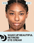 Pacifica Wake Up Beautiful Retinoid Eye Cream – Anti-Aging Under Eye Cream for Fine Lines & Wrinkles, Infused w/ Retinoid, Melatonin & Mushrooms for Puffiness, Dark Circles & Eye Bags Daily Treatment