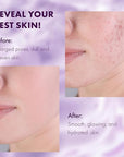 DERMAdoctor Ain't Misbehavin' Dermatologist Formulated Clarifying and Hydrating Toner with Glycolic Acid & Lactic Acid; For Oily and Acne Prone Skin, Pore Minimizer for Face and Body - 6 fl oz