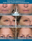 Plexaderm rapid reduction eye serum