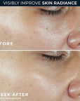RoC Multi Correxion Revive + Glow Vitamin C Broad Spectrum SPF 30 Moisturizer (1.7 oz) with Retinol Eye Cream Packette