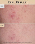 Beauty of Joseon Eye Serum and Replenishing Rice Milk Korean Skin Care