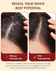 Folliculitis Leave-On Dry Scalp Serum - Non-Greasy Serum for Hair Build-up with Salicylic Acid, Tea Tree Oil & Peppermint Oil - Flaky & Itchy Scalp Care by e70, 2 fl. oz