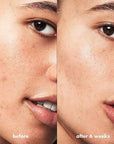e.l.f. SKIN Blemish Breakthrough Blemish Control