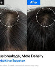 Refilled Hair Recovery Cyrokine Booster 100ml