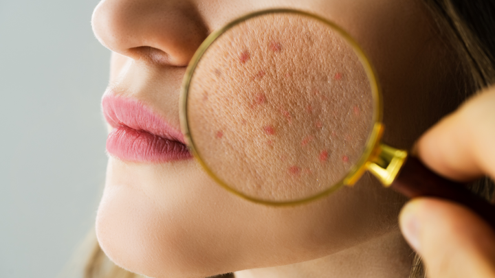 Common Skincare Mistakes That Might Be Sabotaging Your Skin