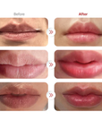 PRIeRE Lip Filler