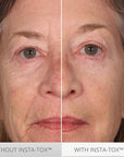 Serious Skincare INSTA-TOX Instant Wrinkle Smoothing Serum - Improves appearance of Fine Lines & Wrinkles - Temporary Skin Tightener - Instant Line Filler - Two .75 Fl Oz Tubes (2Pack)