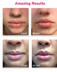 LifeCell Lip Plumping Treatment – Glossy Balm with MaxiLip Peptides for Fuller, Smoother Lips – Hydrating, Non-Irritating, Fragrance-Free Lip Care for All Skin Types