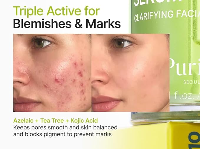 PURITO Azelaic Acid 10% + Kojic Acid + Tea Tree Facial Serum | for Acne & Marks, Breakouts | High-Level Azelaic Acid 10% | Korean skincare, 30mL 1.01 fl.oz
