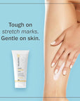 TriLASTIN-SR Intensive Stretch Mark Cream Bundle Fast-Acting