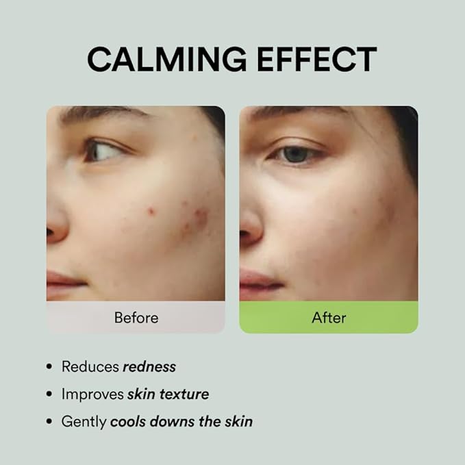 Abib Heartleaf Spot Pad Calming Touch 80pads 5.07 fl.oz. | Korean Acne Soothing Toner Pads for Face, Cleansing, Disposable, Exfoliant, Skin Care