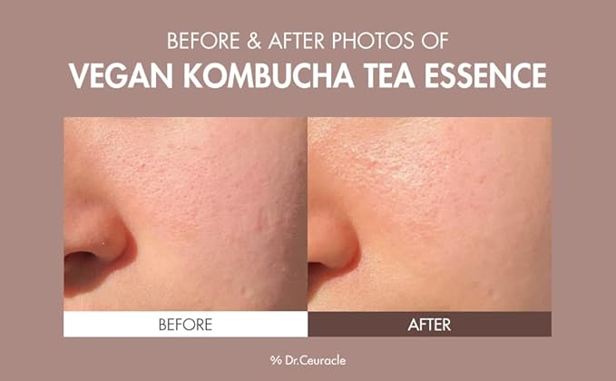 Dr.Ceuracle Vegan Kombucha Cream Essence Toner - Korean Skincare Hydrating Milky Toner with Kombucha Tea Extract, Centella Asiatica, Ceramide (150 ml / 5.07 fl. oz.)