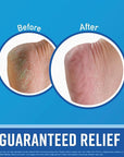 O'Keeffe's Healthy FEET Foot Cream