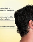 BONDIBOOST Intensive Thickening Spray [4.23 fl oz], Daily Leave In Hair Treatment to Reduce Hair Loss, Lightweight Mist for Thinning Hair + Density for Men & Women, Rosemary & Tea Tree Formula