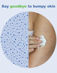 KP Elements Keratosis Pilaris Lotion (4 fl oz) - Natural Keratosis Pilaris Treatment, Moisturizing & Exfoliating AHA Lotion for KP, Vegan, Made in USA
