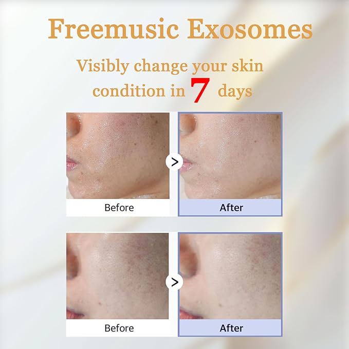 Japan's New Exosome Revolution Deeper Absorption Premium PUA Exosome Firmer Radiant Skin, at-Home Treatment with Collagen Peptides Hyaluronic Acid