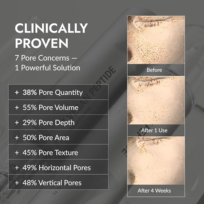 MIZON 7 Vegan Peptide Booster Serum Korean Anti-Aging Face Serum with Niacinamide & Hyaluronic Acid Hydrating Firming & Smoothing Skincare for Fine Lines & Skin Repair – 5.07 fl oz