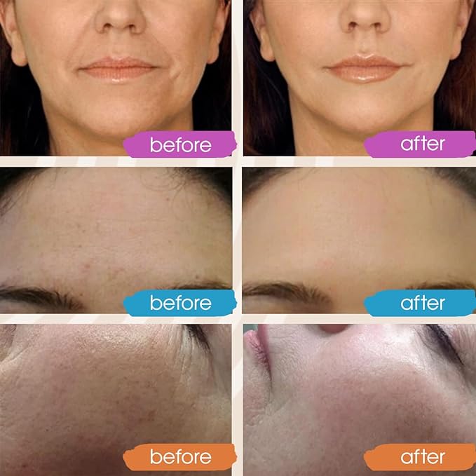 GLEOW Vitamin C Face Serum, Hydrating Vitamin C Serum for Face with Hyaluronic Acid, Suitable For All Skin Types, Targets the Appearance of Dull Spots 2oz