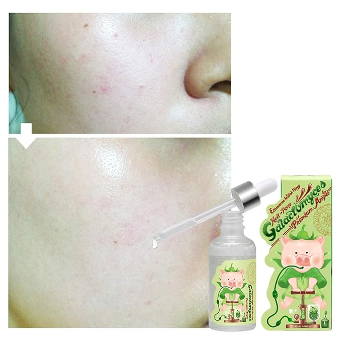 Elizavecca Galactomyces 97% Premium Ample 50Ml - Functionality for Improvement for skin and Wrinkles/water ample before and after/water serum/water essence/water serum before and after