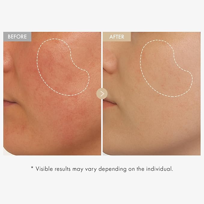 TOSOWOONG Real Rice Glow Serum with 80% Rice Bran Water and Niacinamide for Dark Spots, Uneven Skin Tone, Dull Skin, Radiant Glow, and Daily K-Beauty Skincare for All Skin Types, 33ml / 1.11 fl. oz.