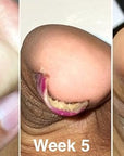 Probelle Natural Fungal Nail Oil,