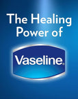 Vaseline Lip Balm 20g/0.705oz (6X20g/0.705oz, Aloe