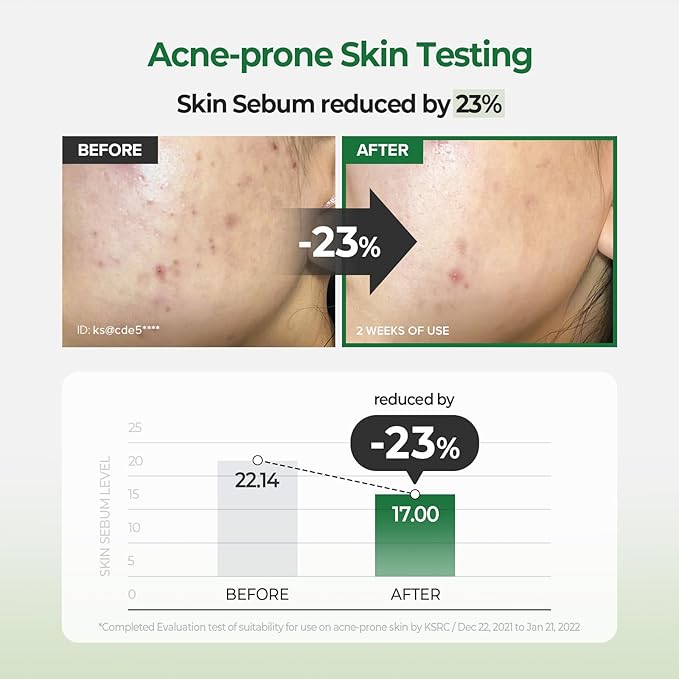 SKINFOOD Pantothenic Water Parsley Clear Toner Pad, Daily Exfoliating Pads for Sensitive Skin, Korean Skincare Sebum Control Face Toner for Trouble Skin, 8.81 oz (60 Pads)