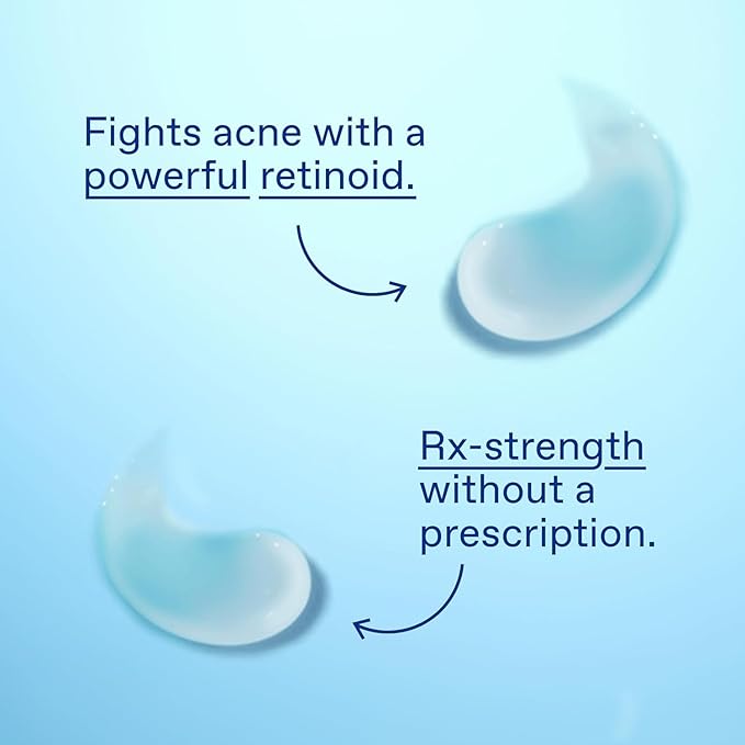 Differin Acne Treatment Gel, 30 Day Supply, Retinoid Treatment for Face with 0.1% Adapalene, Gentle Skin Care for Acne Prone Sensitive Skin, 15g Tube (Packaging May Vary)