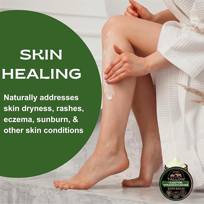 Handmade Tallow, Castor Oil, and Frankincense Oil Skin Balm - 100% Grass-Fed Tallow for Skin Care - Face & Body Moisturizer for Sensitive Skin, Eczema All-Purpose Balm - 2 FL. oz.