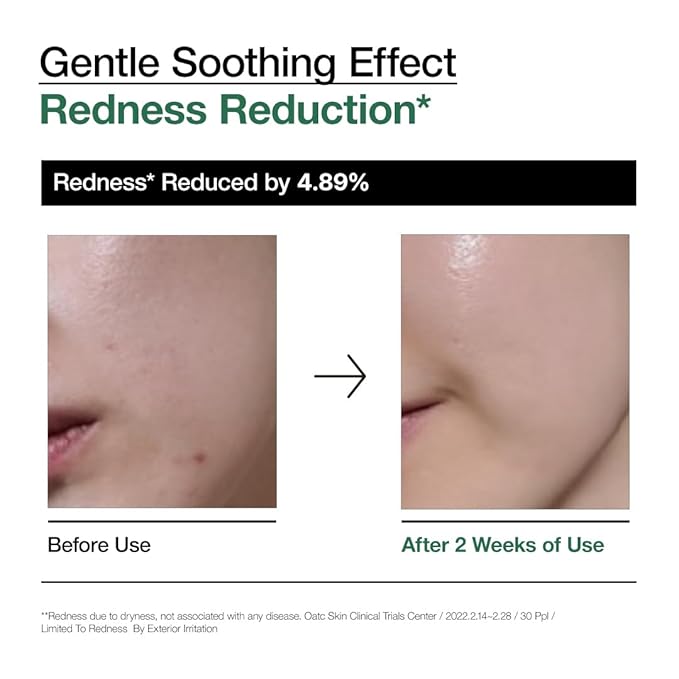 Anua Heartleaf 80 Soothing Ampoule, Hydration Facial Serum for Glass Skin, Panthenol, Hyaluronic Acid, Non-Greasy, Gentle Formula, Lightweight Essence, Vegan, Korean Skin Care, 30ml/1.01 fl.oz