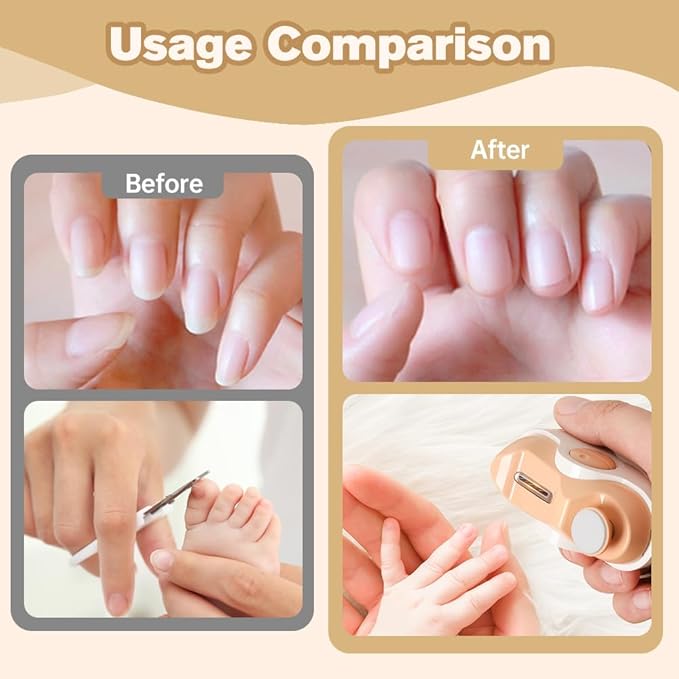 3 in 1 Electric Polishing Automatic Nail Clippers, 2026 New Automatic Nail Trimmer Clippers for Fingers and Toes with 2 Adjustable Speeds, Electric Toe Nail Cutter for Thick Toenails Seniors (White)