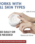 OUKEYA Urea Cream 40 Percent,Foot & Hand Cream for Dry Cracked,Urea Lotion for Feet Maximum Strength(4 Packs)