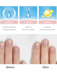 Dr.Althea Dear.A Luminous Nail Essence