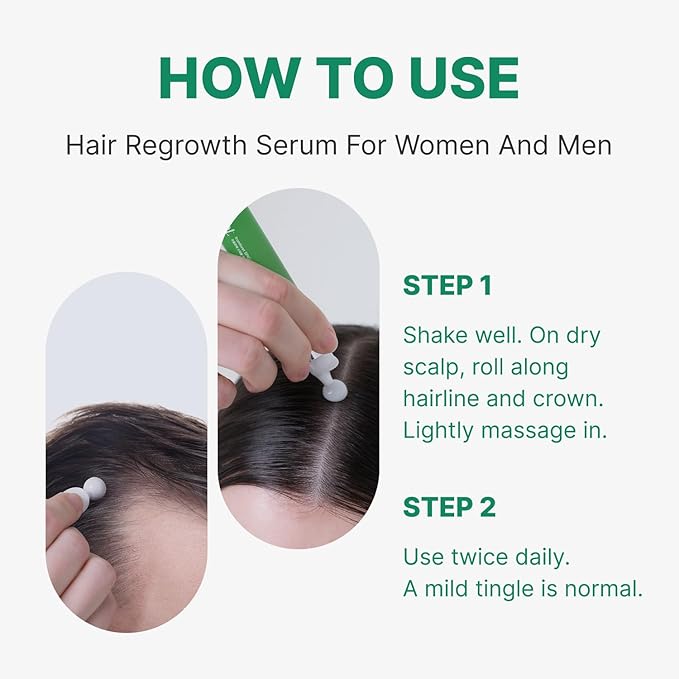 Spicule Microneedling Exosome Hair Growth Serum, Hair Loss Treatments for Women and Men, Peppermint Oil Cooling Scalp Serum, Menthol, Korean Hair Care (0.5 fl oz / 15ml)