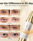 Hydrating Caffeine Eye Serum for Dark Circles & Puffiness - Anti-Wrinkle, Firming & Smooths Fine Lines - Retinol Under Eye Serum Treatment - 0.45 Oz