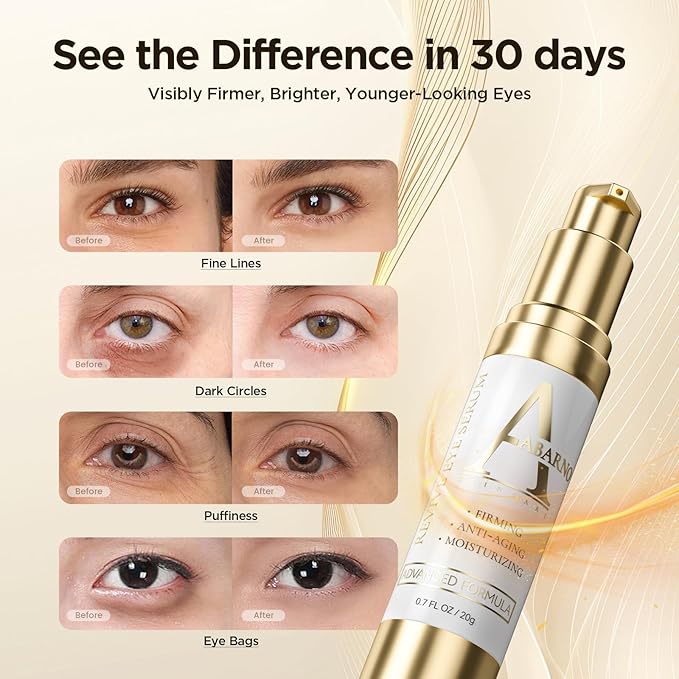 Hydrating Caffeine Eye Serum for Dark Circles & Puffiness - Anti-Wrinkle, Firming & Smooths Fine Lines - Retinol Under Eye Serum Treatment - 0.45 Oz