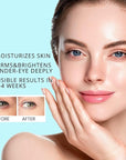 Retinol Under Eye Stick Balm: Cooling Eye Cream for Dark Circles Fine Lines Puffiness, Anti Wrinkle Hydrating Face Skincare in 3-4 Weeks