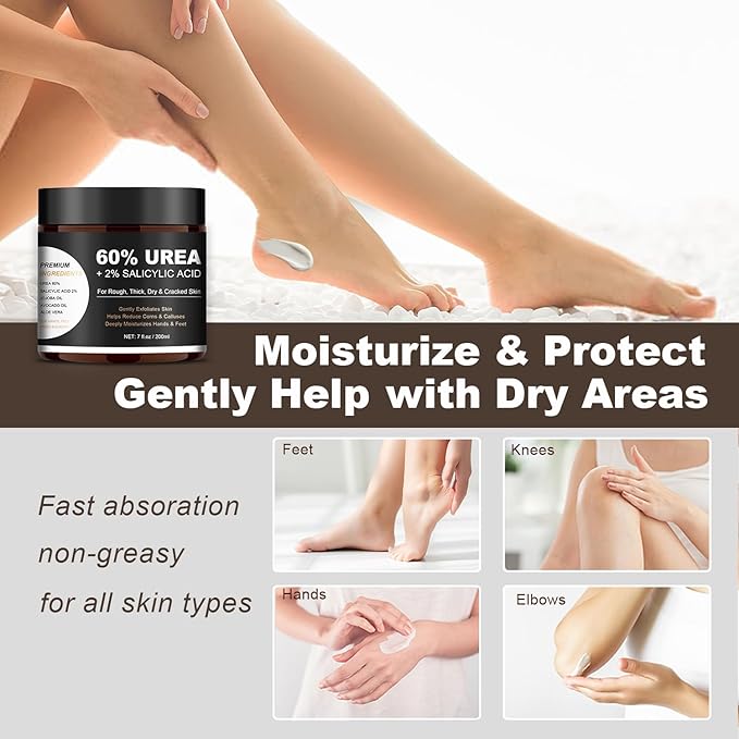 60% Urea Foot & Hand Cream with 2% Salicylic Acid - Intensive Moisturizer for Dry, Cracked Heels, Feet, Elbows, Hands and Knees - Callus Remover lotion with Jojoba Oil, Avocado Oil & Aloe Vera, 7 oz