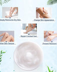 OUKEYA Urea Cream 40 Percent,Foot & Hand Cream for Dry Cracked,Urea Lotion for Feet Maximum Strength(4 Packs)