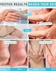 Urea Cream 40 Percent For Feet Maximum Strength - plus Salicylic Acid 2% Foot Cream For Dry Cracked Heels Feet Knees - Dead Skin Cuticle Callus Remover Toenail Softener