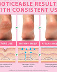 Urea Cream 60% Plus Salicylic Acid 2% Foot Balm Stick for Dry Cracked/Chapped Heel, Skinned knees, Hand Intensively Hydration/Moisturization, Callus Removal/Softening/Soothing-Peach Scent|1.41 Oz/40 G
