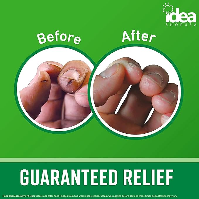 Idea Shop USA O’Keeffe Working Hands Cream 3.4oz + Work Gloves Bundle – Moisturizing Lotion for Dry, Cracked Hands with Protective Gloves for Gardening, Cleaning, DIY, and Everyday Hand Care