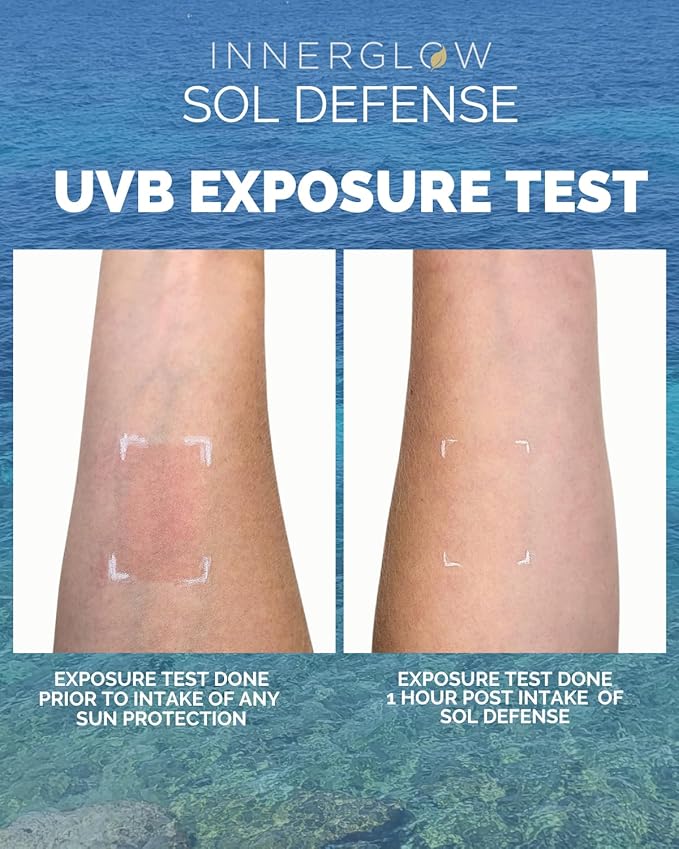 Sol Defense Gummies – Dermatologist & Plastic Surgeon-Formulated Skin Resilience Vitamin Supplement with Polypodium Leucotomos & Niacinamide, Passion Fruit Flavor, 60 Sugar-Free Gummies