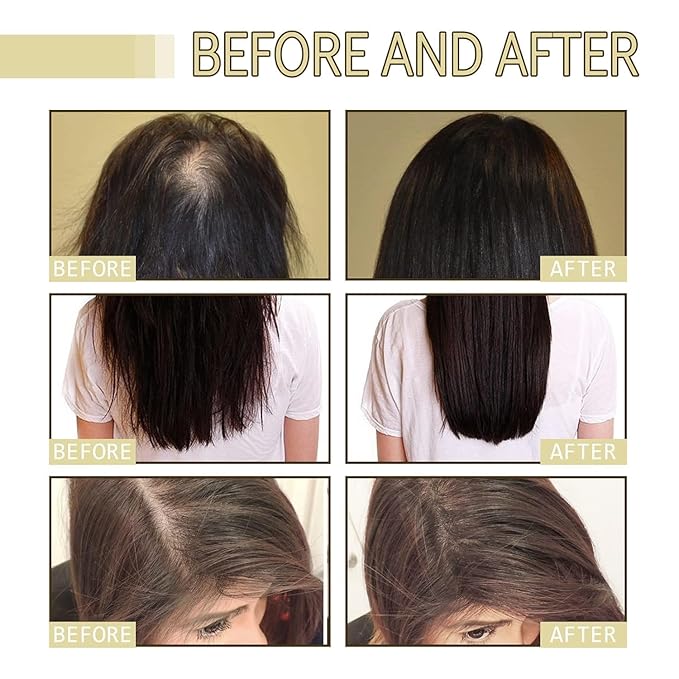 180ML Natural Hair Growth, Rosemary Oil for Hair Growth Organic, Rosemary Oil for Dry Damaged Hair and Growth Thin Hair （3PCS）